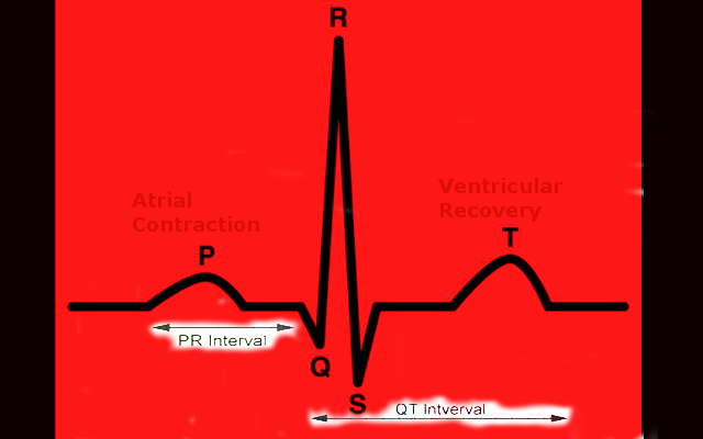 ECG Intervals