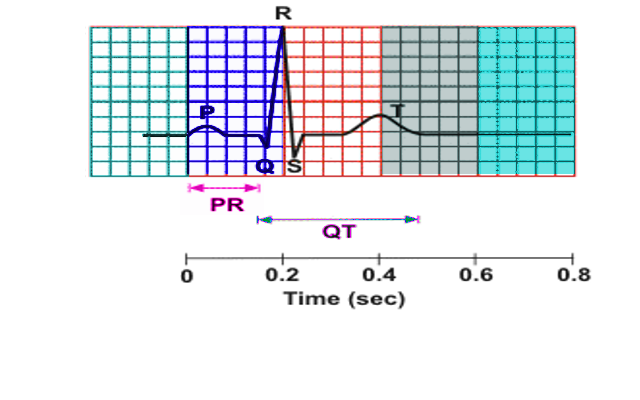 ECG Squares