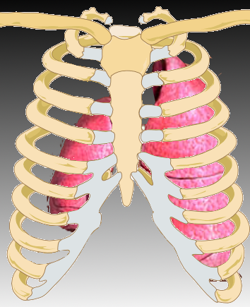 Figure 1 showing a gross anatomical view of complete right lung collapse.